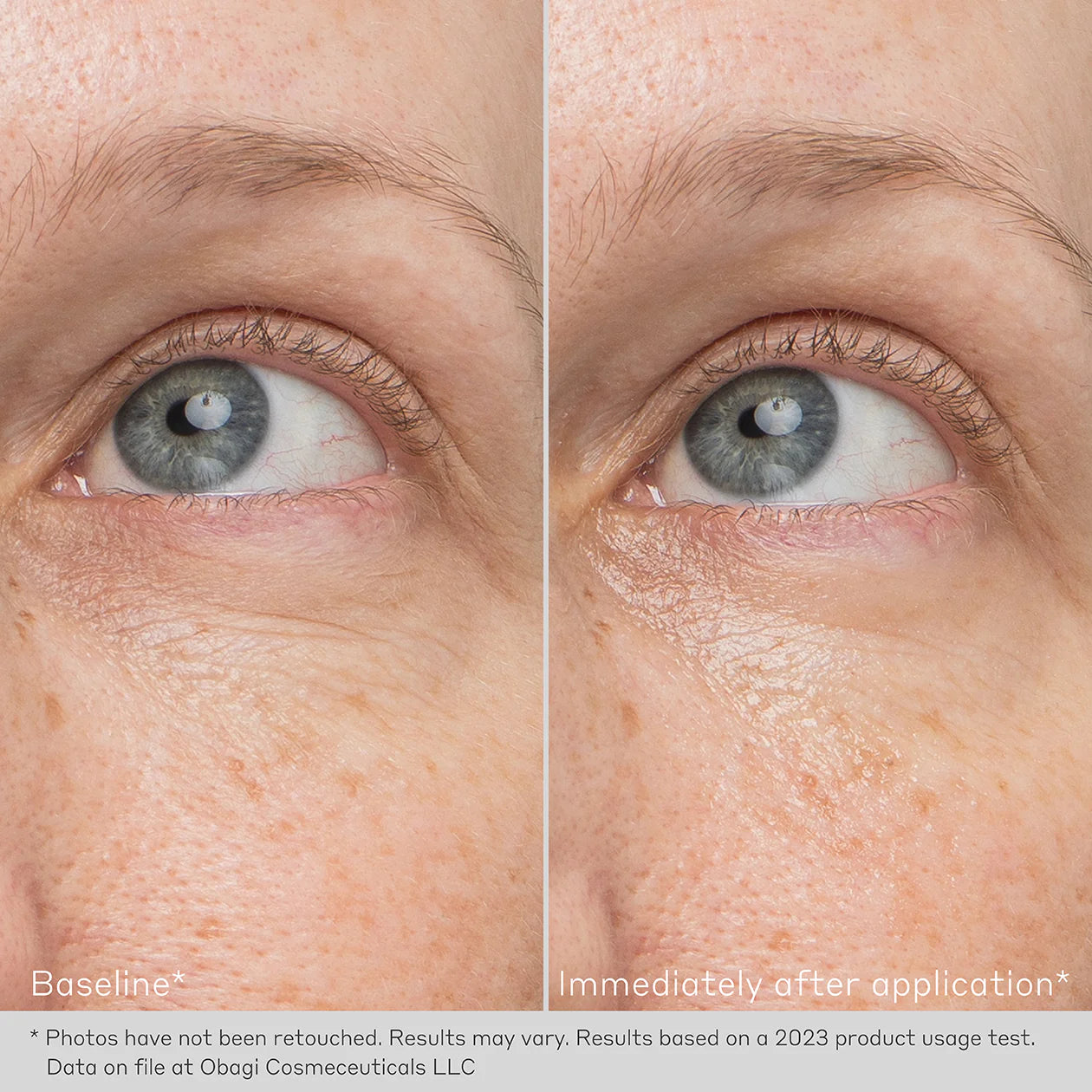 Obagi Daily Hydro Drops Rejuvenating Eye Gel Cream