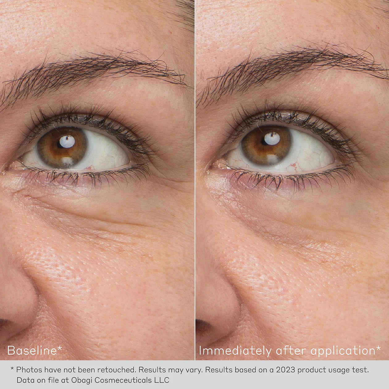 Obagi Daily Hydro Drops Rejuvenating Eye Gel Cream